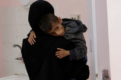 hu4sqlj5wpkhawqtugjspsg56q Matar también de hambre en Gaza