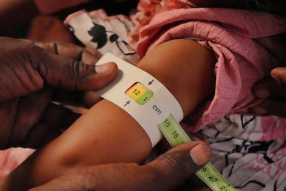 Un técnico del Programa Mundial de Alimentos hace una prueba de malnutrición en un menor en Omdurmán (Sudán) Food Program (WFP) en abril de 2025.