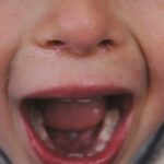 Los niños con arrebatos emocionales tienen más posibilidades de depresión de adolescentes