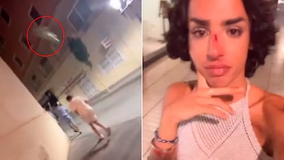 e6goy2dljvaivhc6hkcw5vdocm-1 Captura del vídeo subido por el joven agredido a Instagram donde se ve cómo le lanzan una botella.