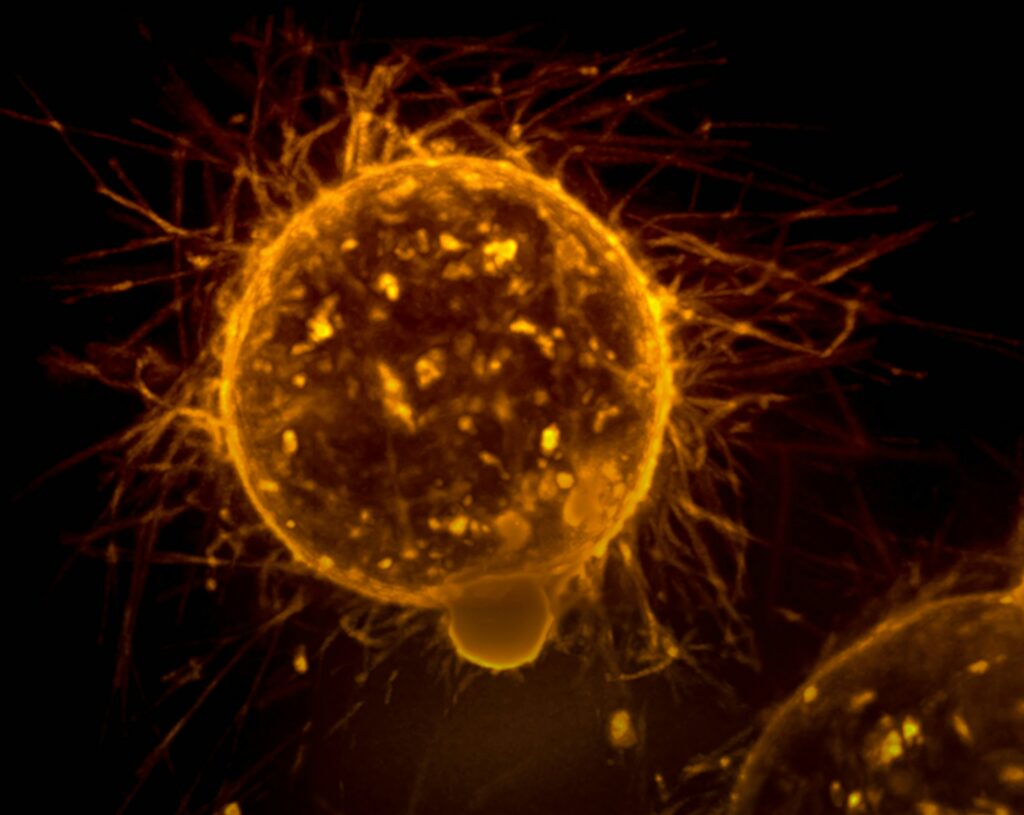 national-cancer-institute-vv-ycnzesag-unsplash-1024x815-1 El cáncer es la principal causa de muerte entre los hispanos de EE.UU., según un estudio - national-cancer-institute-vv-ycnzesag-unsplash-1024x815